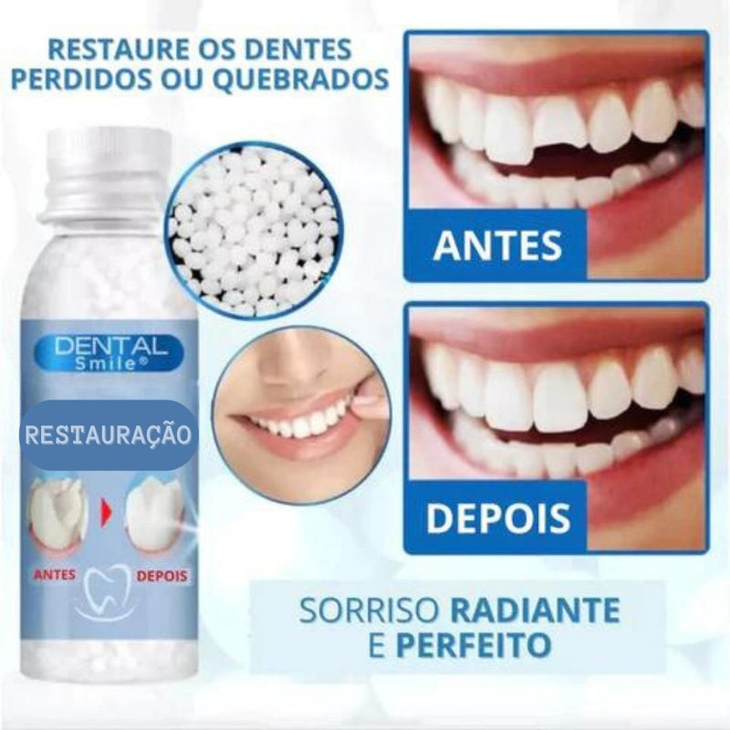 Restauração Dentária Smile, Pague 1 Leve 2